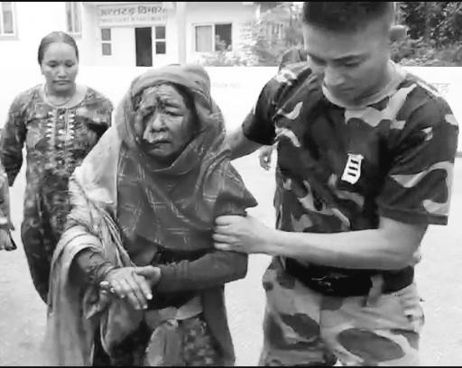 च्याउ टिप्ने क्रममा भालुको आक्रमणमापरी एक महिला गम्भिर घाईते